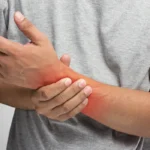 Joint-Pain-And-Swelling
